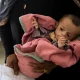 'Children dying of malnutrition in Afghanistan:' report